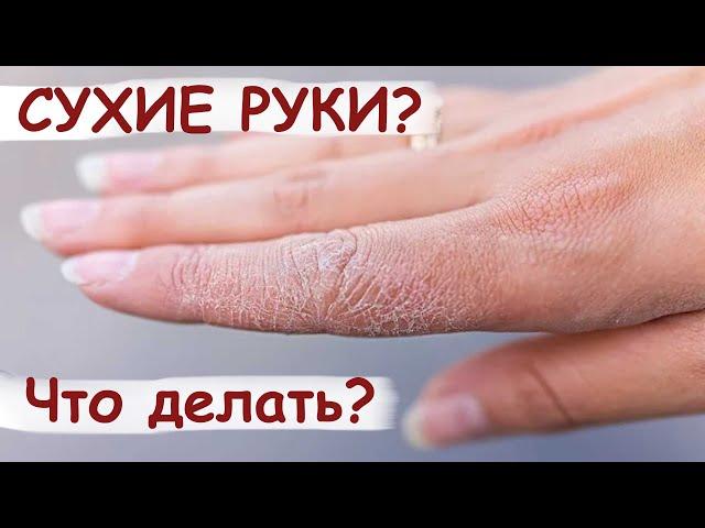 Как сделать руки ухоженными? ТРИ МОЩНЫХ Средства от СУХОСТИ РУК.