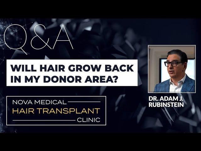 Does hair grow back at donor area after Hair Transplant?