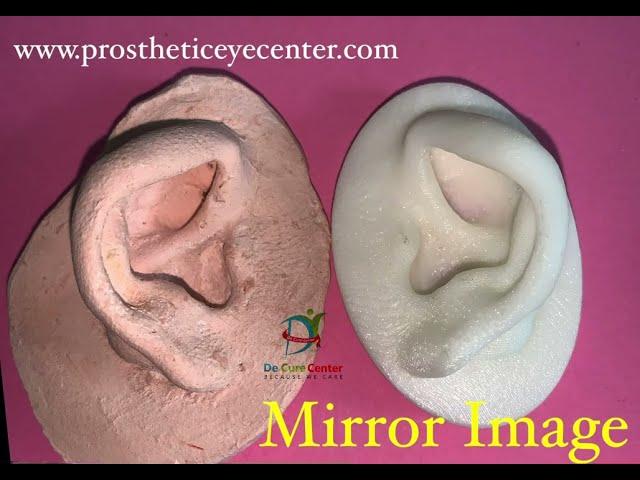 Silicone Artificial Ear | Microtia | Auricular Prosthesis.