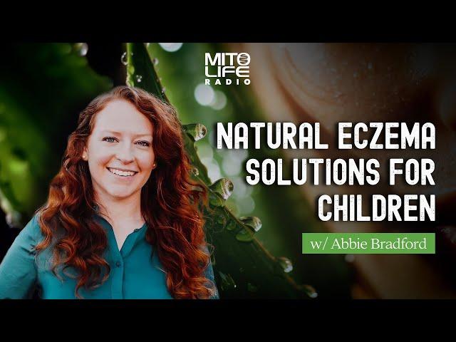 Natural Eczema Solutions for Children with Abbie Bradford | Mitolife Radio Ep. #279