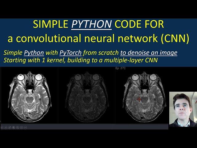 Simple code for convolution and a CNN to denoise an image with real-time display in Python / PyTorch