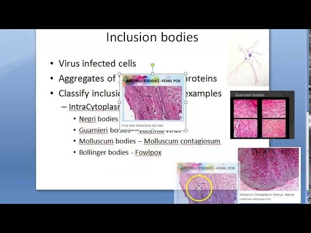 Microbiology 447 a Inclusion Bodies Virus negri bodies classify guarnieri vaccinia molluscum