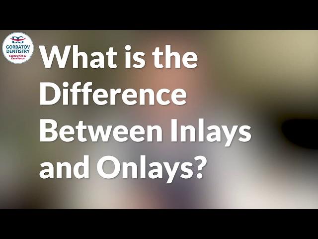 What is the Difference Between Inlays and Onlays?