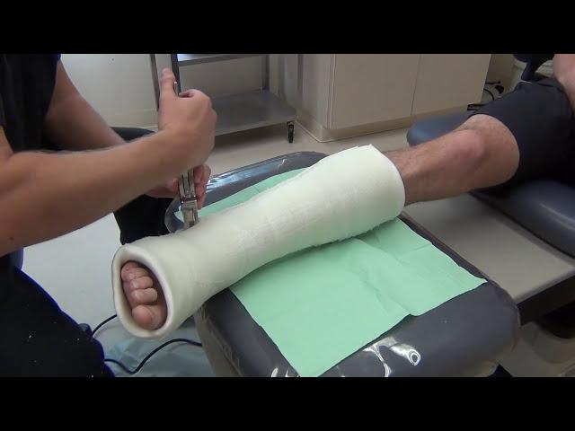 Removing and Bivalving a Cast