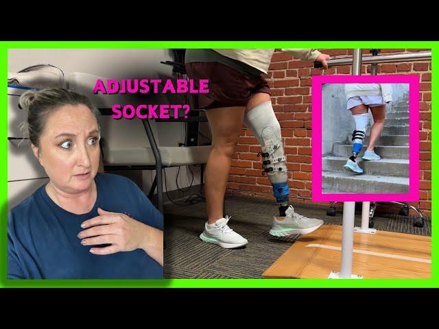 Below The Knee amputee review of Martin Bionics adjustable socket for prosthetic leg