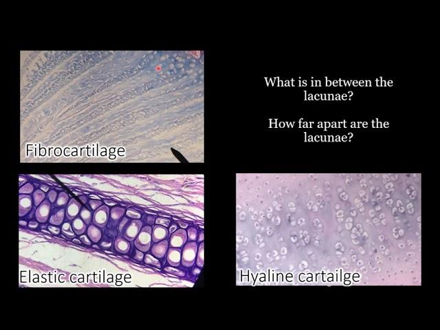 Identifying Cartilage | Review and Practice Questions