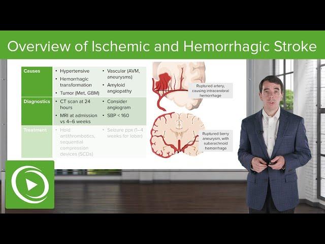 Overview of Ischemic and Hemorrhagic Stroke | Clinical Neurology