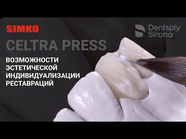 Стеклокерамика CELTRA PRESS | Возможности эстетической индивидуализации реставраций