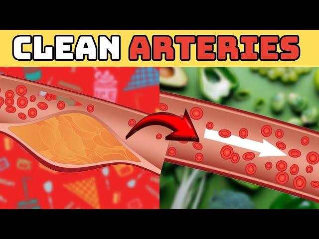 Top 10 Foods that Clog And Unclog Arteries Naturally and Prevent Heart Attack