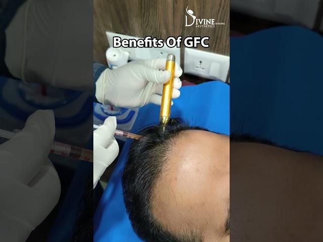 GFC Procedures and Benefits of GFC | Hair Fall Treatment