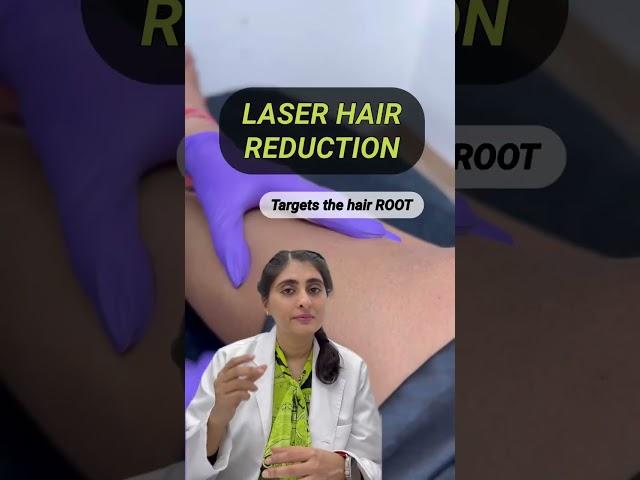 Waxing hair removal | laser hair removal | waxing or laser| waxing at home #shorts