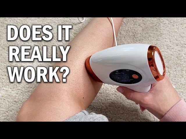 Aopvui IPL Hair Removal Device Review - Does It Really Work?