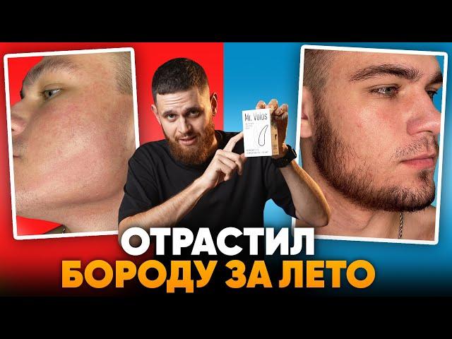 С НУЛЯ отрастил бороду за лето. Результаты Mr.Volos