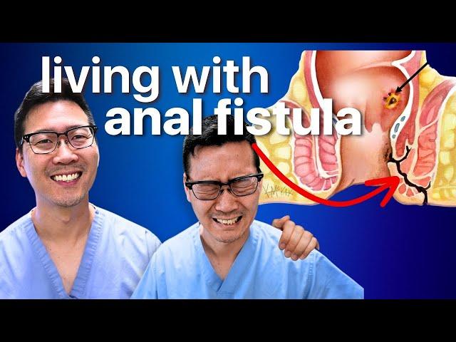 How to live with Anal Fistula!