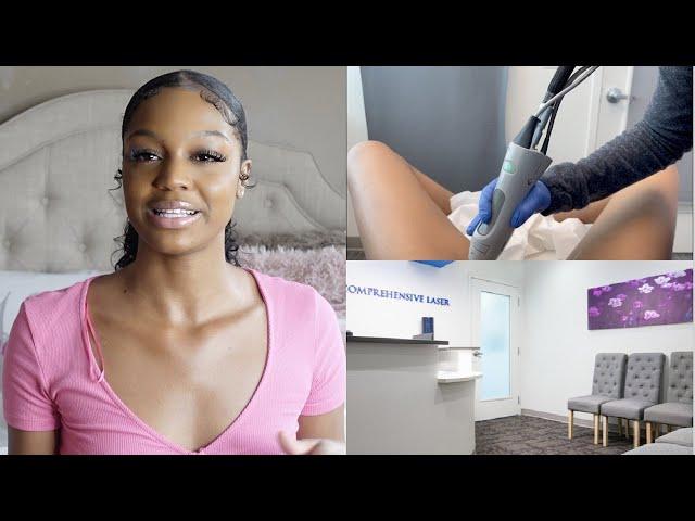 BRAZILIAN LASER HAIR REMOVAL | EVERYTHING YOU NEED TO KNOW! | Noelle Christina