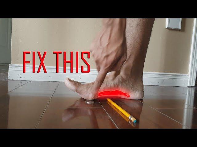 ARE ORTHOTICS THE SOLUTION? HOW TO FIX FLAT FEET (Fallen Arches/Overpronation)