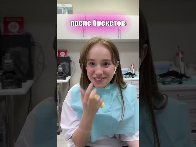 КАК МОЯ ЖИЗНЬ ИЗМЕНИЛАСЬ С БРЕКЕТАМИ #shorts #tiktok # a4 #брекеты