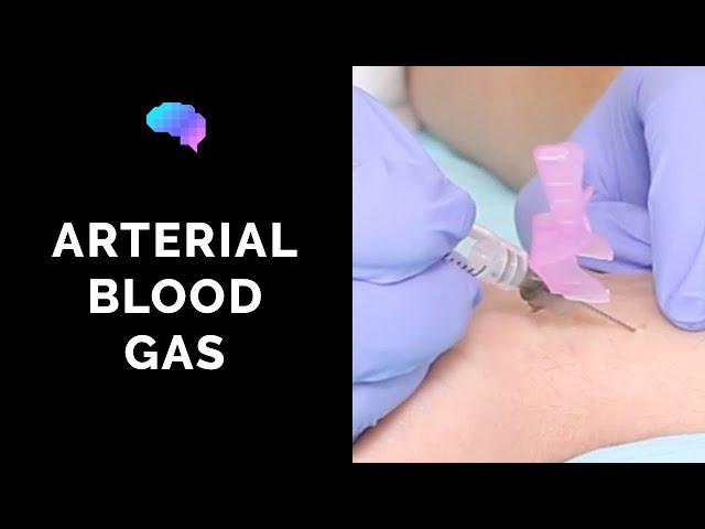 How to take an arterial blood gas (ABG) - OSCE guide | UKMLA | CPSA | PLAB 2