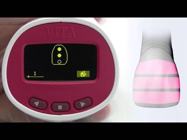 VITA Easyshade Advance 4.0 Part 10 Measurement of the Tooth Area