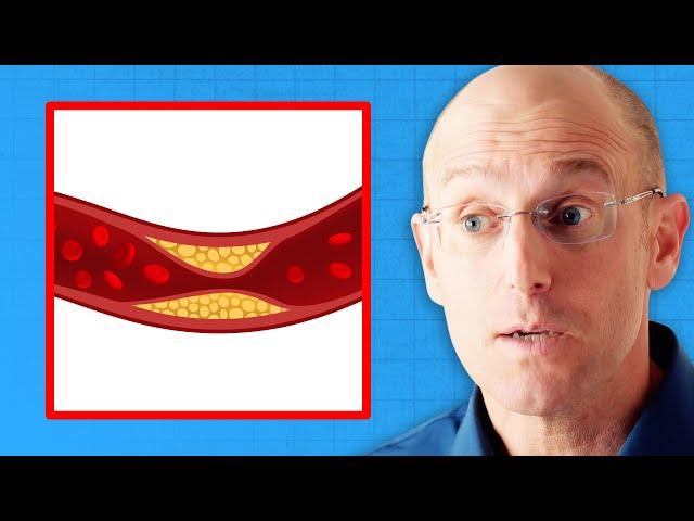 Cardiologist’s TRUTH About Saturated Fat and Clogged Arteries | Dr. Bret Scher