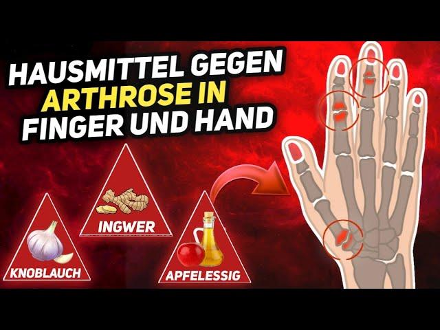 7 Natürliche Hausmittel gegen Arthrose in Finger und Hand