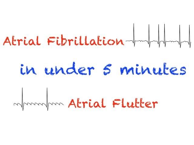 AFib and AFlutter Interpretation Under 5 minutes