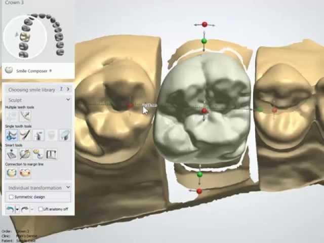 Intro to Dental CAD/CAM - The Tools