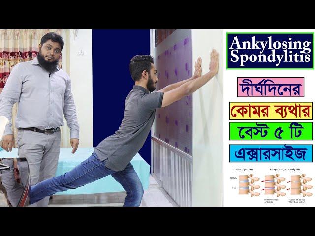 Ankylosing Spondylitis | দীর্ঘদিনের কোমর ব্যথা ভাল করার এক্সারসাইজ- Low back pain relief exercise