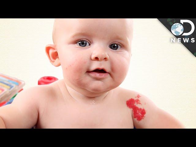 Why Do We Have Birthmarks?