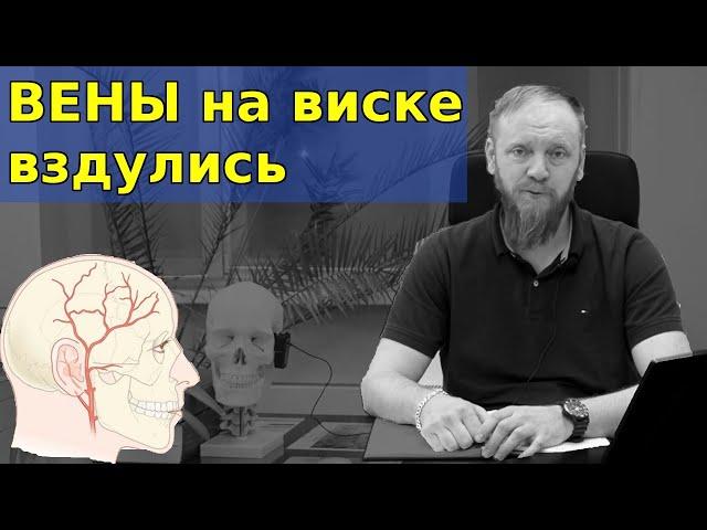  Вена на виске вздулась и пульсирует (причина и как убрать)