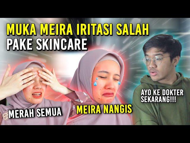 MUKA MEIRA IRITASI KARENA SALAH SKINCARE! KE DOKTER SEKARANG JUGA!