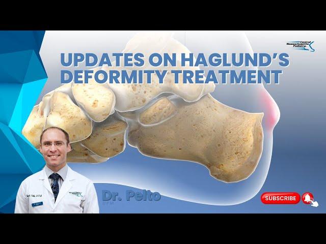 Updates on Haglund's deformity treatment