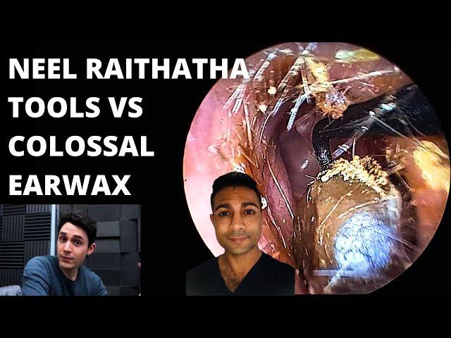 The Neel Raithatha Tools VS Colossal Earwax Blockage (First Impressions)