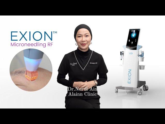 Microneedling RF With BTL Exion.