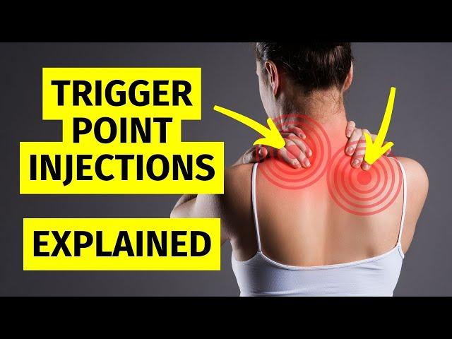 Myofascial Pain Trigger Point Injections Explained