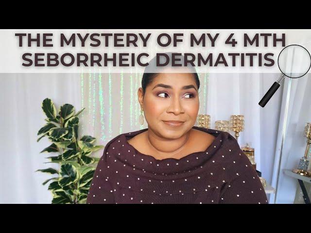 I can't believe this caused my Seborrheic Dermatitis!! Supplements? Stress? Dust? |SheriApproved