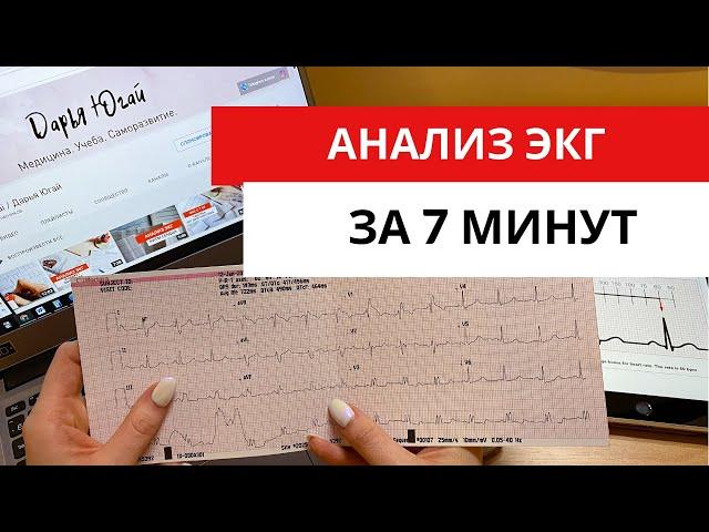 Научись анализировать ЭКГ за 7 минут!!! (Подробный разбор ЭКГ).