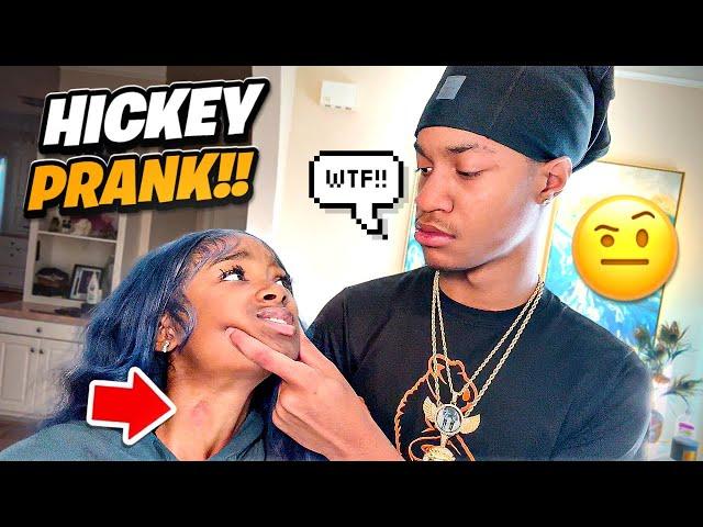 Hickey Prank On Boyfriend!! *GONE WRONG*