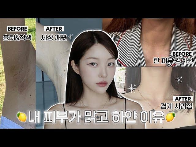 (eng) 언니 피부 어떻게 하얘졌어요? + 찐으로 효과본 미백템들, 겨드랑이 착색 관리템, 탄 피부 되돌리는 법 | 소윤Soyoon