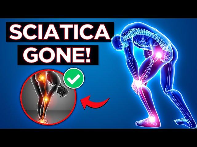 Fix Your Sciatica: 3 Diagnostic Tests and 3 Exercises for Pain Relief!