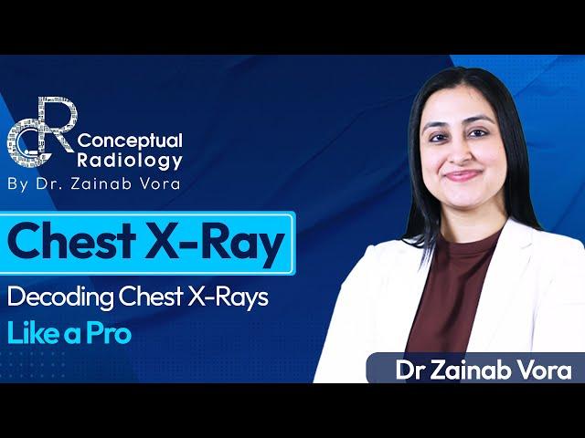 Decoding Chest X-Ray Like a Pro with Dr. Zainab Vora | Conceptual Radiology