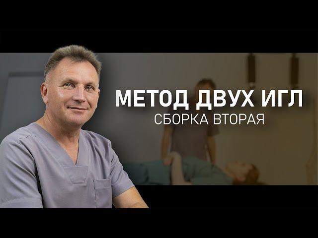 МЕТОД ДВУХ ИГЛ. Сборка II | Владимир Александров