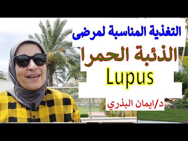 الذئبة الحمرا | Lupus | الأطعمة المفيدة  و الاطعمه الضارة | التغذية المناسبه