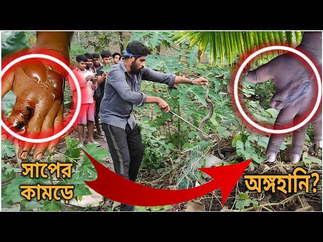 অঙ্গহানির জন্য দায়ী এই সাপ! Russell's Viper Fatality | বিশাল চন্দ্রবোড়া সাপ!@SnakeSaverBrothers