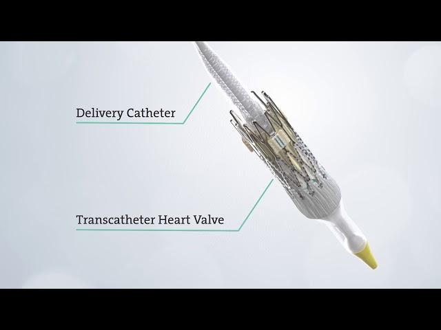 Transcatheter Aortic Valve Replacement (TAVR) - See the Procedure