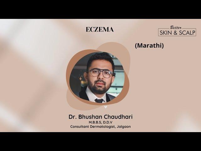 Eczema : Dr. Bhushan Chaudhari, Jalgaon (Marathi)