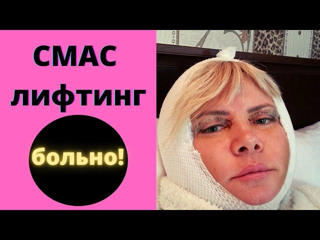 Блефаропластика и СМАС лифтинг. Личный опыт