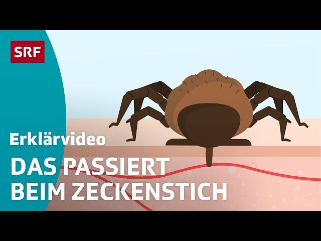 Zeckenstich & übertragbare Krankheiten – einfach erklärt | Kindervideos | SRF Kids