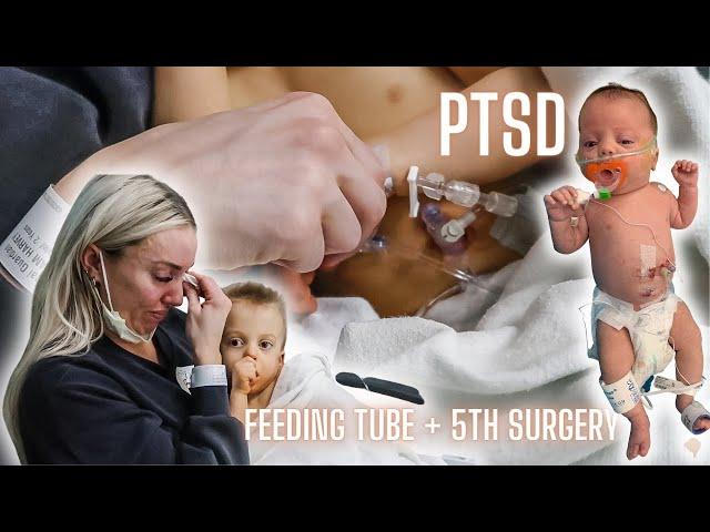 SURGERY VLOG | FEEDING TUBE FOR OUR DISABLED TODDLER *EMOTIONAL + PTSD*