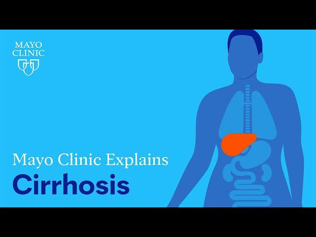 Mayo Clinic Explains Cirrhosis